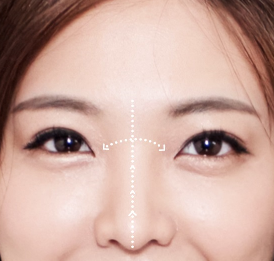 세라믹치과 돌출입교정 투명교정기로 ~ 관련 이미지 10