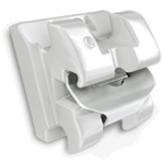 학동역치과 하면 세라믹교정 ~ 관련 이미지 5