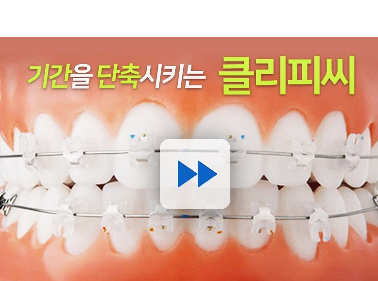 세라믹치과 클리피씨 교정 장점 관련 이미지 5