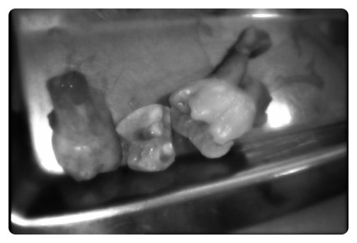 학동역 사랑니발치 관련 이미지 6