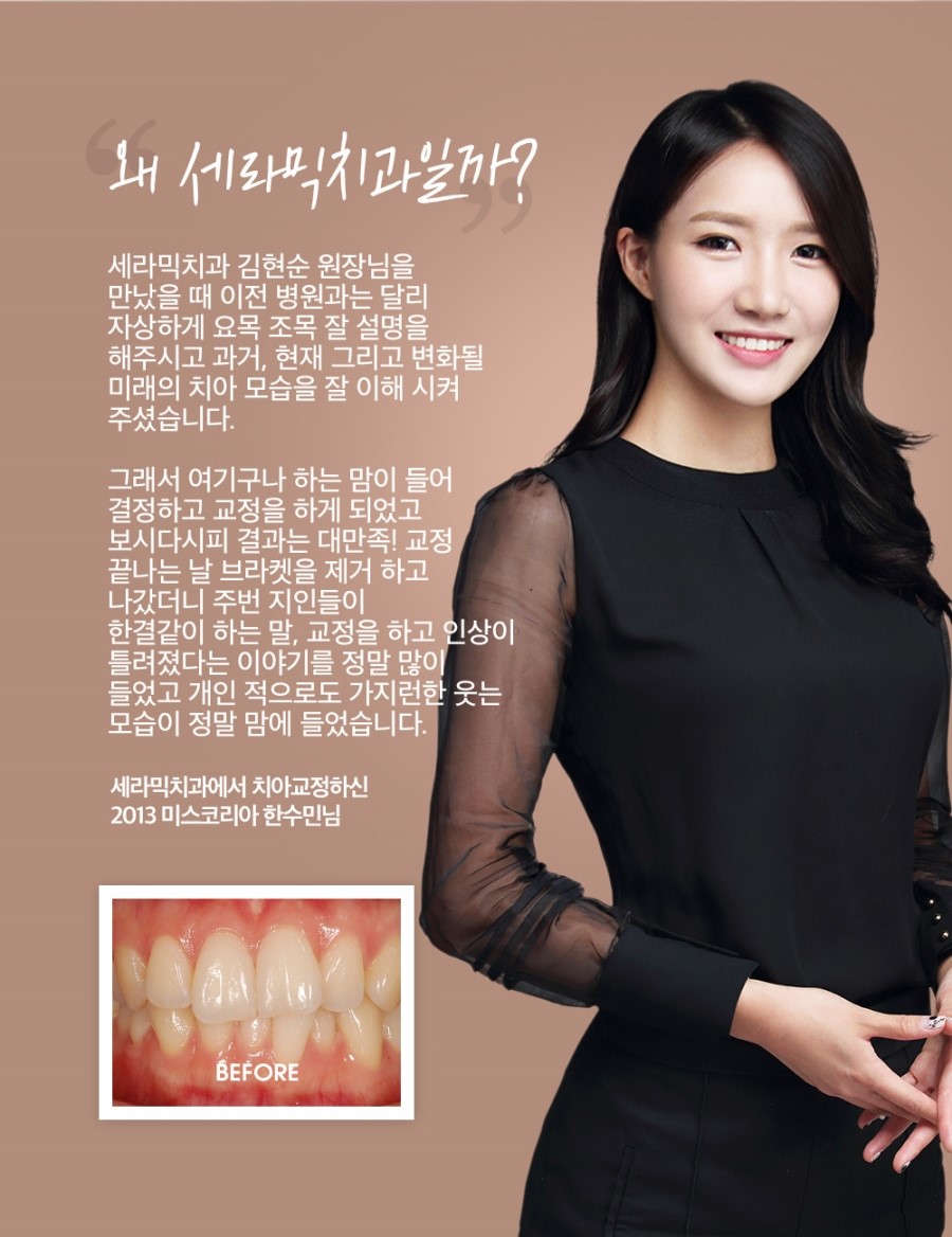 세라믹교정 이벤트 관련 이미지 8