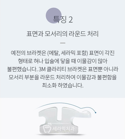 세라믹치과에서 세라믹교정이 인기있는 이유! 관련 이미지 7