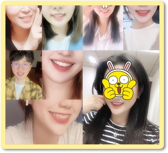 과개교합과 삐뚤빼뚤한 치열, 돌출입 앞니 치아교정전후 관련 이미지 6