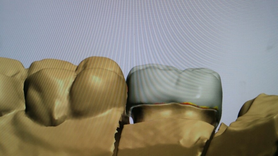 [미소가아름다운치과 양재유]  디지털 기공소 운영 관련 이미지 3