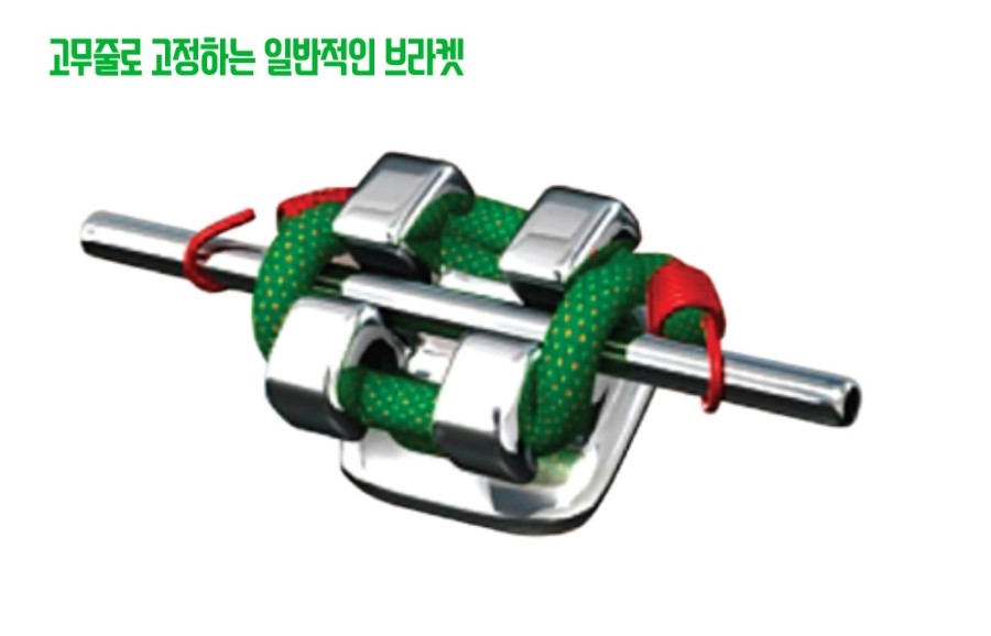 클리피씨교정 기간 짧을까? 관련 이미지 8