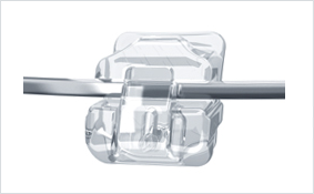 데이몬클리어 vs 클리피씨교정 관련 이미지 2