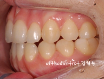 강남교정치과 관련 이미지 29