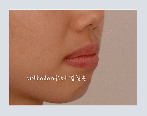 강남교정치과 관련 이미지 5