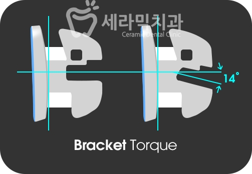 옥니 없이 치아교정잘하는곳, 강남 세라믹치과 관련 이미지 5