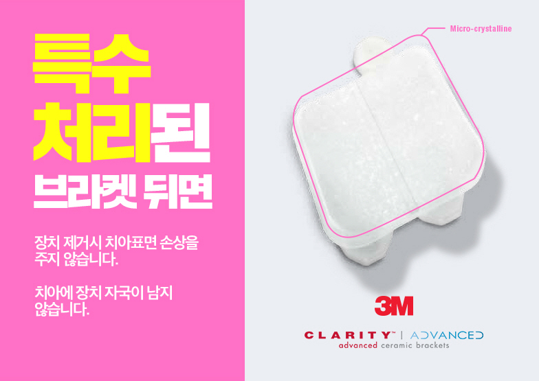 세라믹치과 치아교정만 19년째 관련 이미지 5