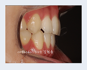 강남교정치과 관련 이미지 15