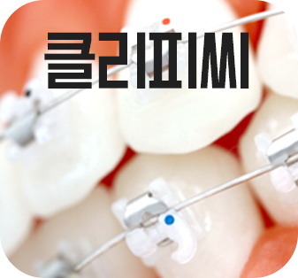 여행기간동안 돌출입 치아교정? 관련 이미지 8