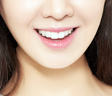 세투교정이란 ? 세라믹투명교정 관련 이미지 1