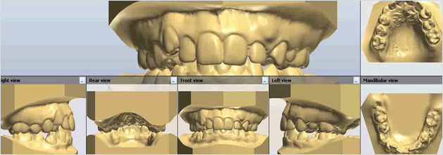 세라믹교정 세라믹치과  "투명교정"의 새이름 "3D미소교정" 관련 이미지 5