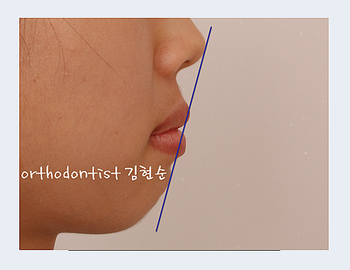 강남교정치과 관련 이미지 7
