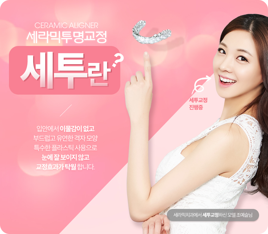 세투교정이란 ? 세라믹투명교정 관련 이미지 2