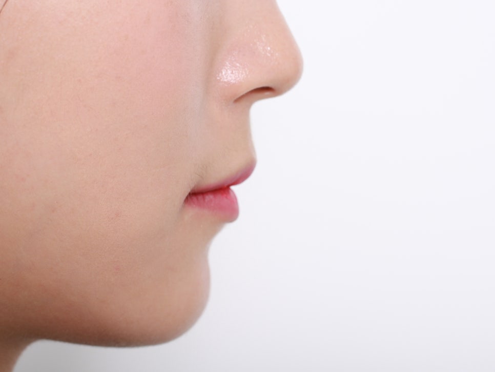 세라믹치과 돌출입교정 발치교정으로 아름답게 ~ 관련 이미지 3