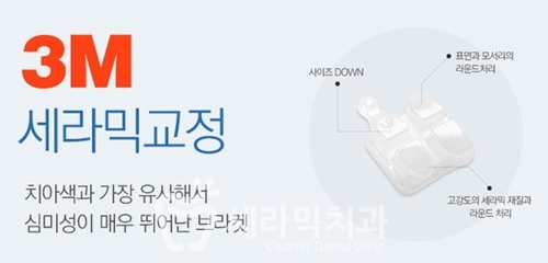 세라믹교정, 세라믹치과에서 하면 좋은 이유! 관련 이미지 3