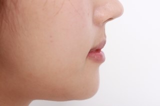 세라믹치과  교정리얼 스토리 관련 이미지 5