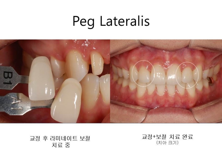 학동역치과 치아교정 잘하는 곳 ! 관련 이미지 34