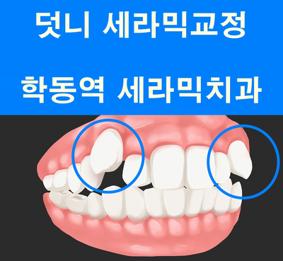 덧니교정 잘하는 학동역 교정치과, 세라믹치과 관련 이미지 1