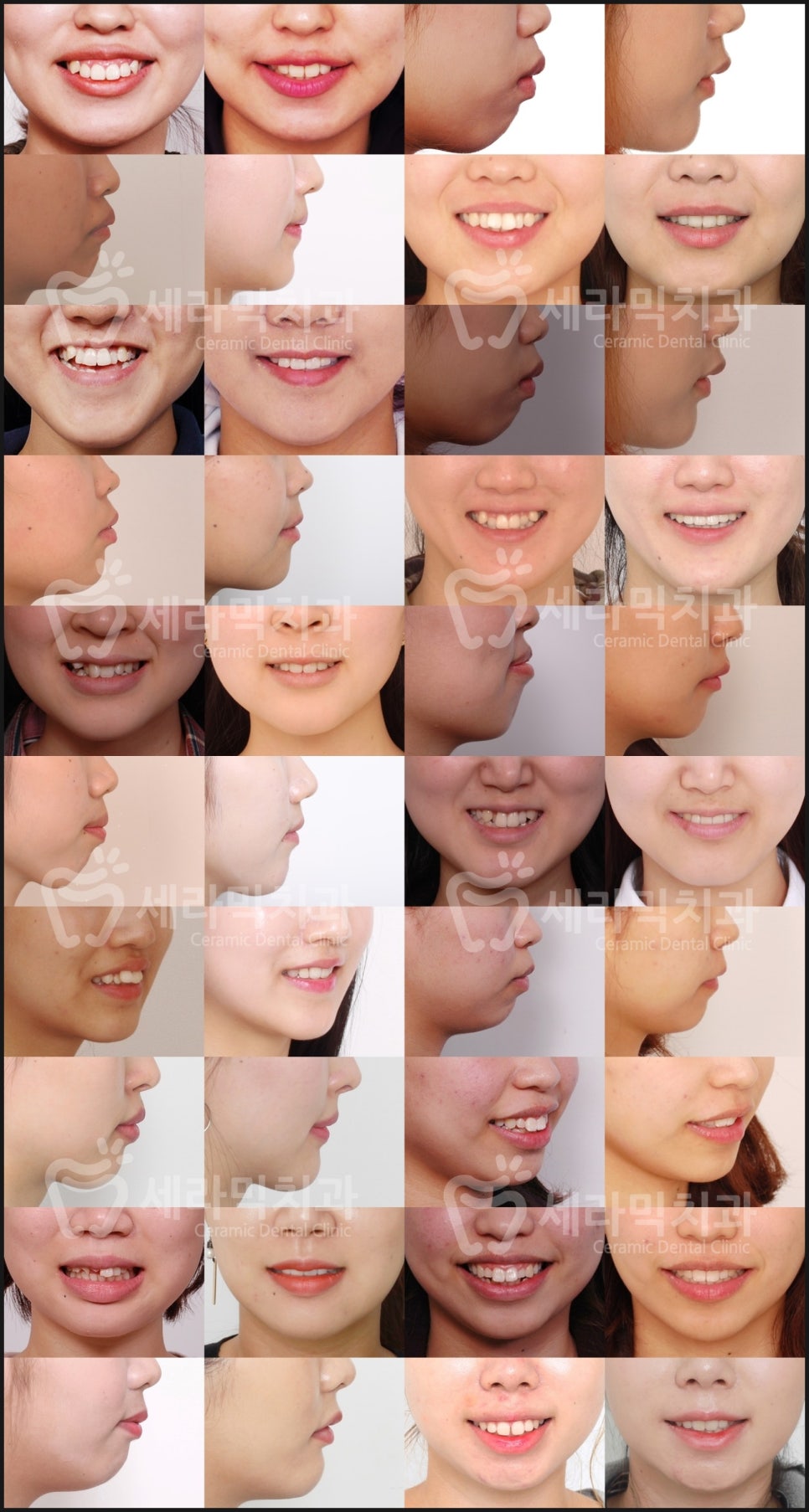 치아교정은 치아교정전문의에게 맡기세요! 관련 이미지 3