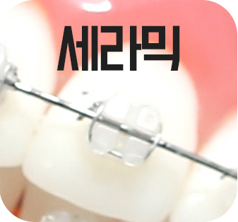 여행기간동안 돌출입 치아교정? 관련 이미지 9