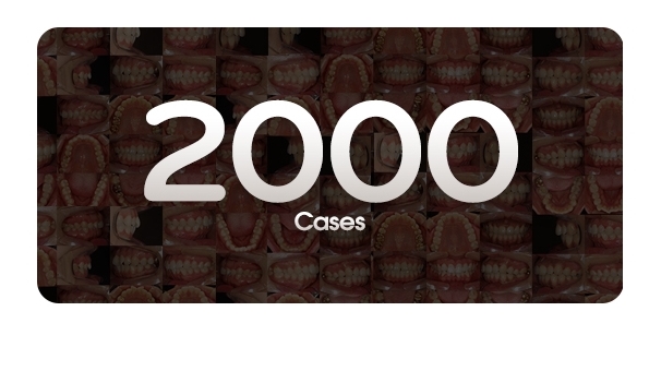 비발치교정 무조건 좋은 것만은 아니다? 관련 이미지 6