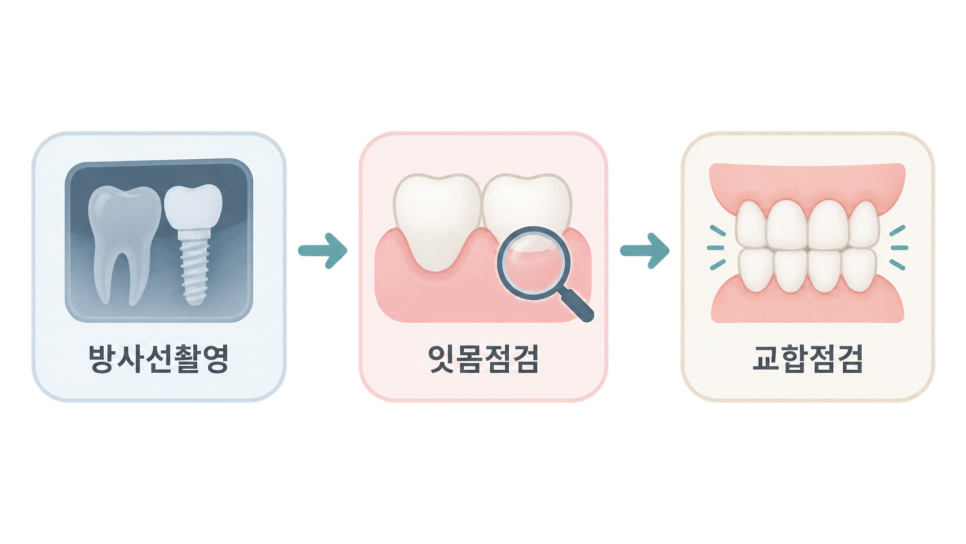 강남구청역 치과에서 임플란트 잇몸 출혈, 정기검진이 중요한 이유 관련 이미지 5