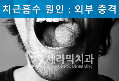 치아교정 부작용 제대로 알기 1. 관련 이미지 8