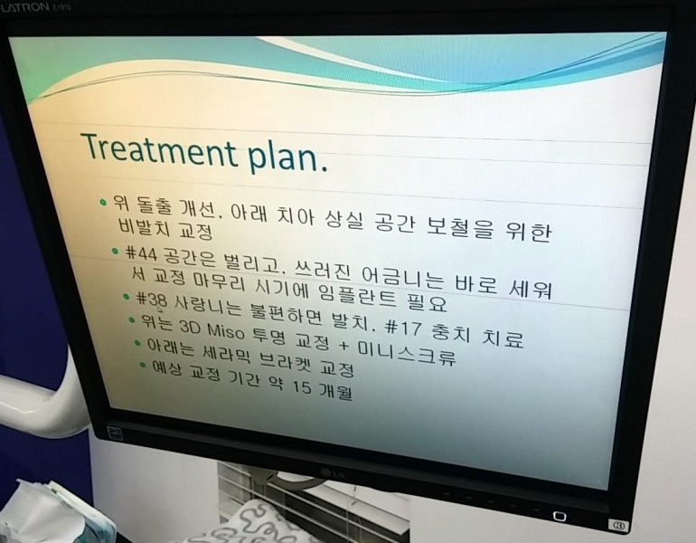 돌출입 교정 실패 그 후 ~ 관련 이미지 5