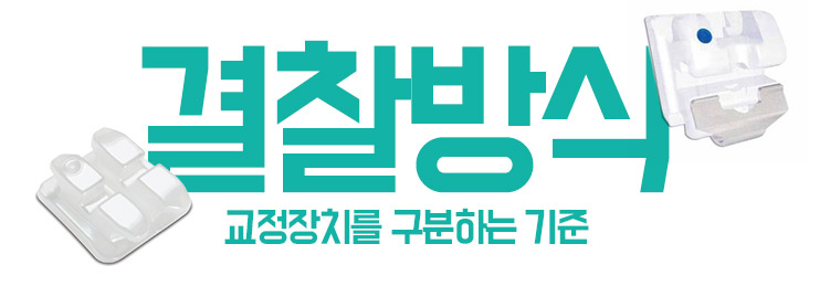 교정장치 구분하기 관련 이미지 2