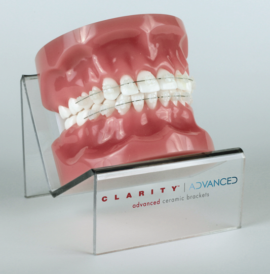 학동역치과 하면 세라믹교정 ~ 관련 이미지 2