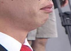 학동역치과 치아교정은 여기서 !! 관련 이미지 16