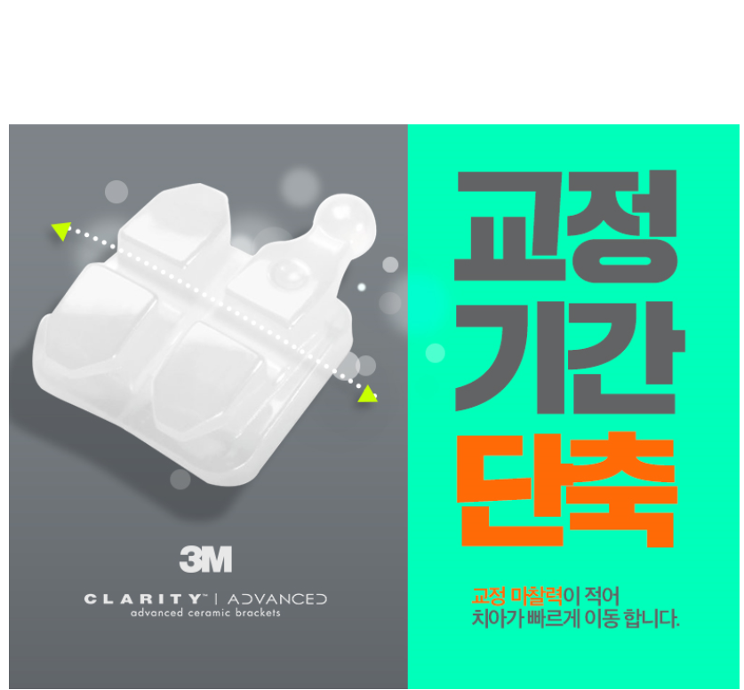 세라믹교정 3M  치아교정 모델 신청 ~ 관련 이미지 4