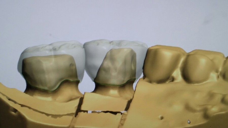 [미소가아름다운치과 양재유]  디지털 기공소 운영 관련 이미지 13