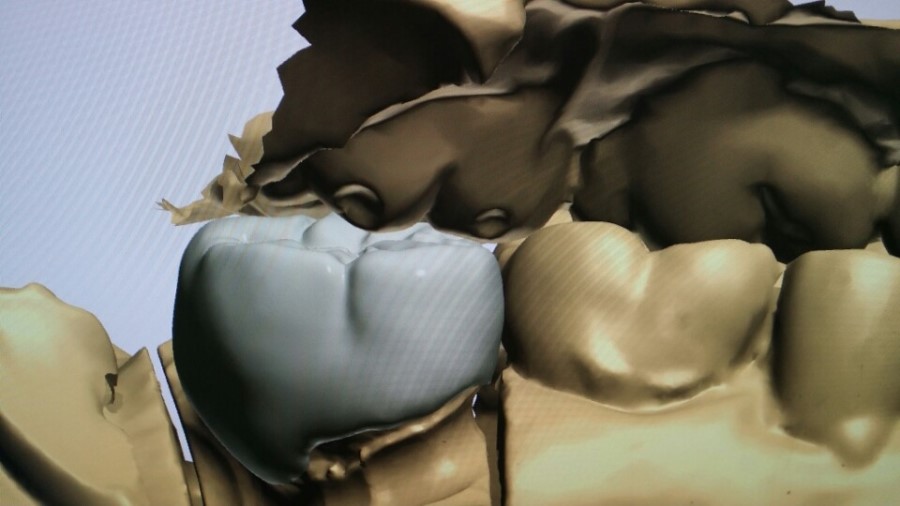 [미소가아름다운치과 양재유]  디지털 기공소 운영 관련 이미지 7