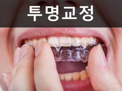 세라믹교정 잘하는 곳은? 세라믹치과 관련 이미지 8