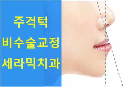 주걱턱 비수술 치아교정 잘하는 학동역 세라믹치과 관련 이미지 1
