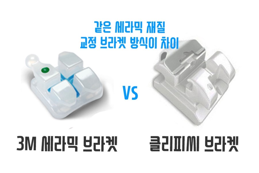 클리피씨 비용 기간단축 관련 이미지 13