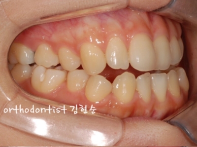 강남교정치과 관련 이미지 32