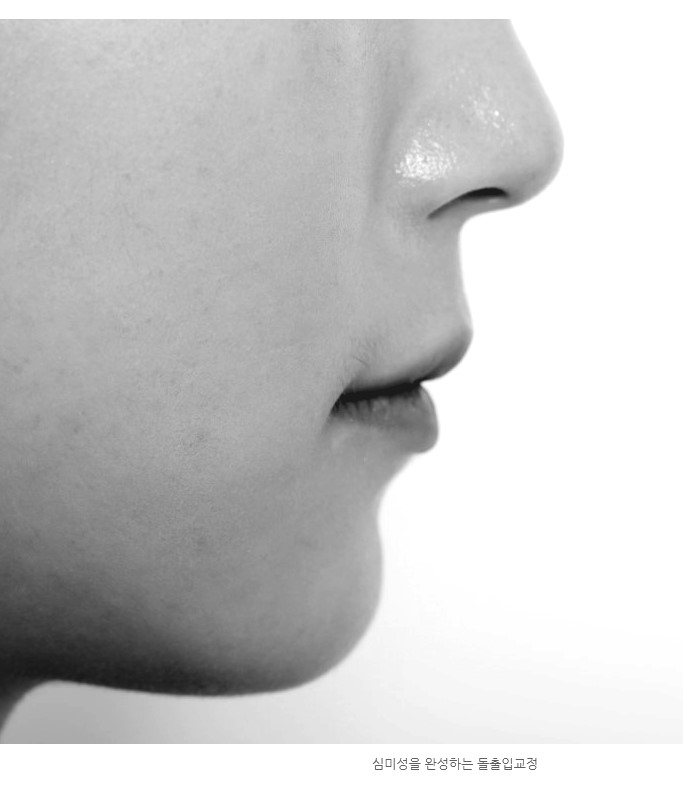 세라믹치과 학동역치과 페레로로쉐 정지연님 광고 관련 이미지 5