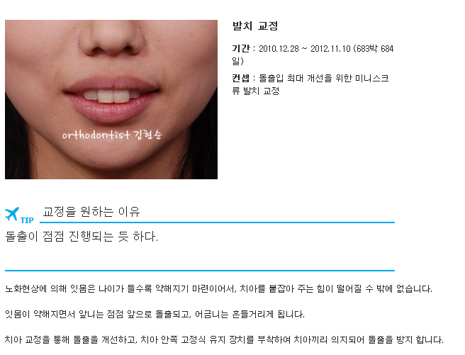 세라믹교정 세라믹치과-돌출입발치교정 10 관련 이미지 2