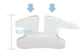 학동역교정치과 세라믹치과 세라믹교정 관련 이미지 4