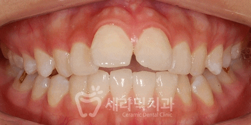 우리 아이 관련 이미지 10