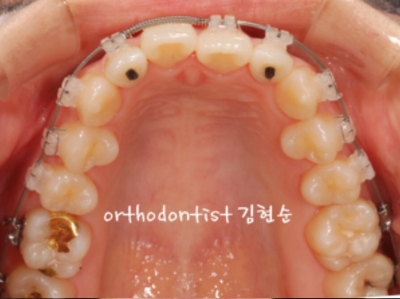 강남교정치과 관련 이미지 18