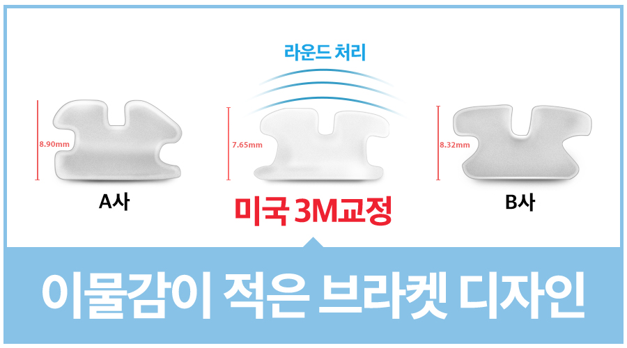 세라믹치과 세라믹교정은 특별하다 ~ 관련 이미지 2