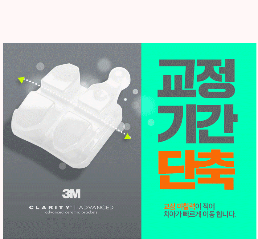 세라믹치과 3M 클래러티 어드밴스 치아교정 전속모델 콘테스트 관련 이미지 4