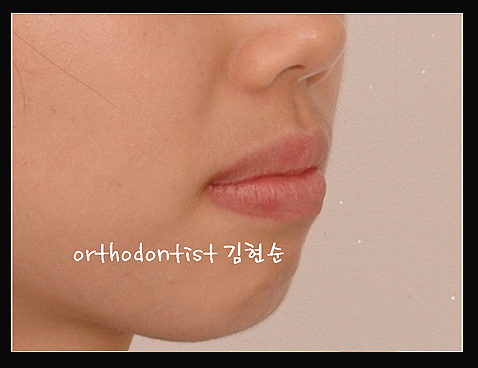 강남교정치과 관련 이미지 33