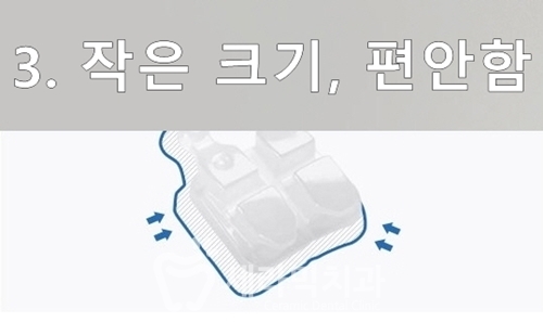 세라믹교정, 세라믹치과에서 하면 좋은 이유! 관련 이미지 6